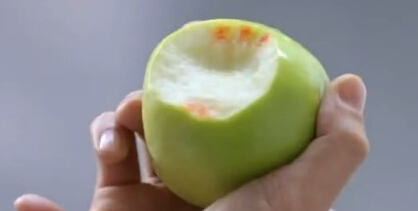 牙龈出血需要看医生吗?